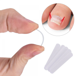 Orthofex Nail-Corrector Spangen Set