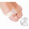 Orthofex Teenscheider met Ring